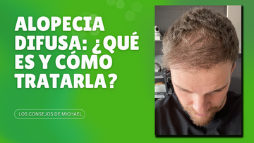 Alopecia DIFUSA o DUPA: ¿qué es y cómo tratarla?