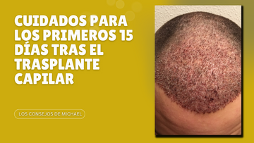 Guía esencial: cuidados durante los primeros 15 días tras un trasplante capilar Los Consejos de MIchael