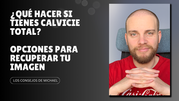 ¿Qué hacer si tienes calvicie total? Guía práctica para abordar la alopecia avanzada