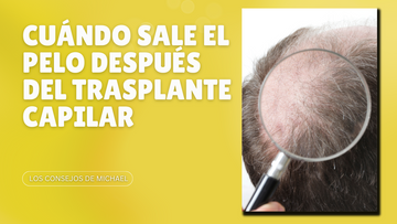 ¿Cuándo sale el pelo después del trasplante capilar? Llevo 4 o 5 meses y no me ha salido pelo