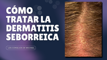 Guía completa para tratar la dermatitis seborreica: consejos efectivos y productos recomendados