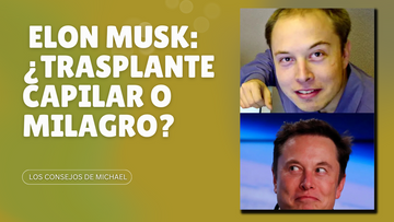El sorprendente cambio de imagen de Elon Musk: ¿trasplante capilar o milagro?