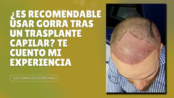 ¿Es recomendable usar gorra tras un trasplante capilar? Te cuento mi experiencia