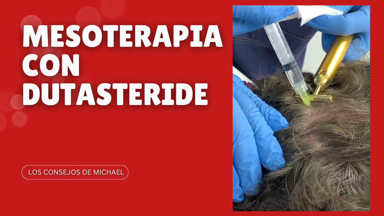 Mesoterapia con dutasteride