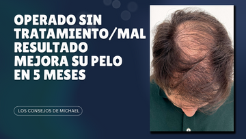 Operado sin tratamiento y con mal resultado mejora su pelo en 5 meses