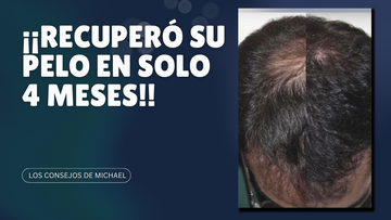 ¡¡RECUPERÓ SU PELO EN SOLO 4 MESES!!