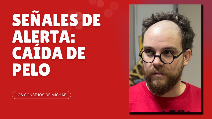 ¿Cuándo la caída del cabello se convierte en un problema?
