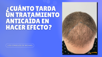 ¿Cuánto tarda un tratamiento anticaída en hacer efecto y mejorar tu pelo?