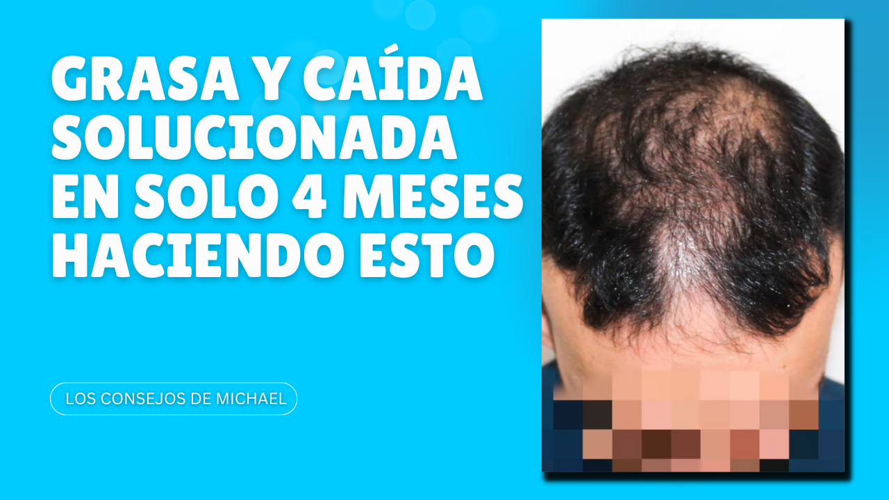 Grasa y caída de pelo solucionada en solo 4 meses haciendo esto
