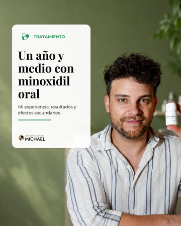 Un año y medio con minoxidil oral. Mi experiencia