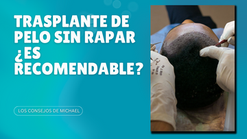 Trasplante de pelo sin rapar: ¿es posible y recomendable?