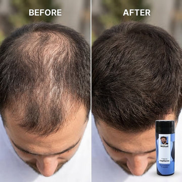 Fibras capilares de keratina natural - Los Consejos de Michael