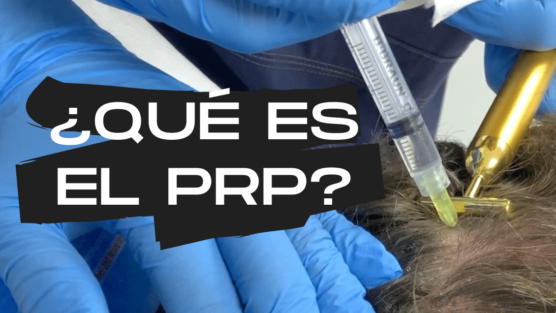 ¿Qué es el PRP?